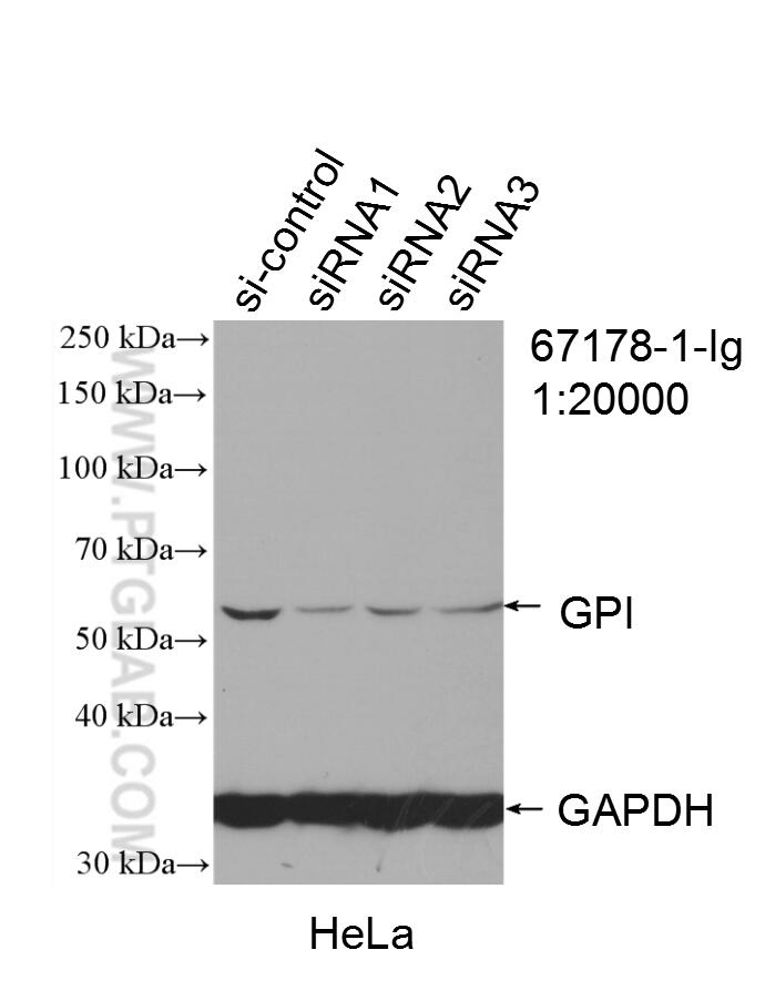 WB analysis of HeLa using 67178-1-Ig (same clone as 67178-1-PBS)