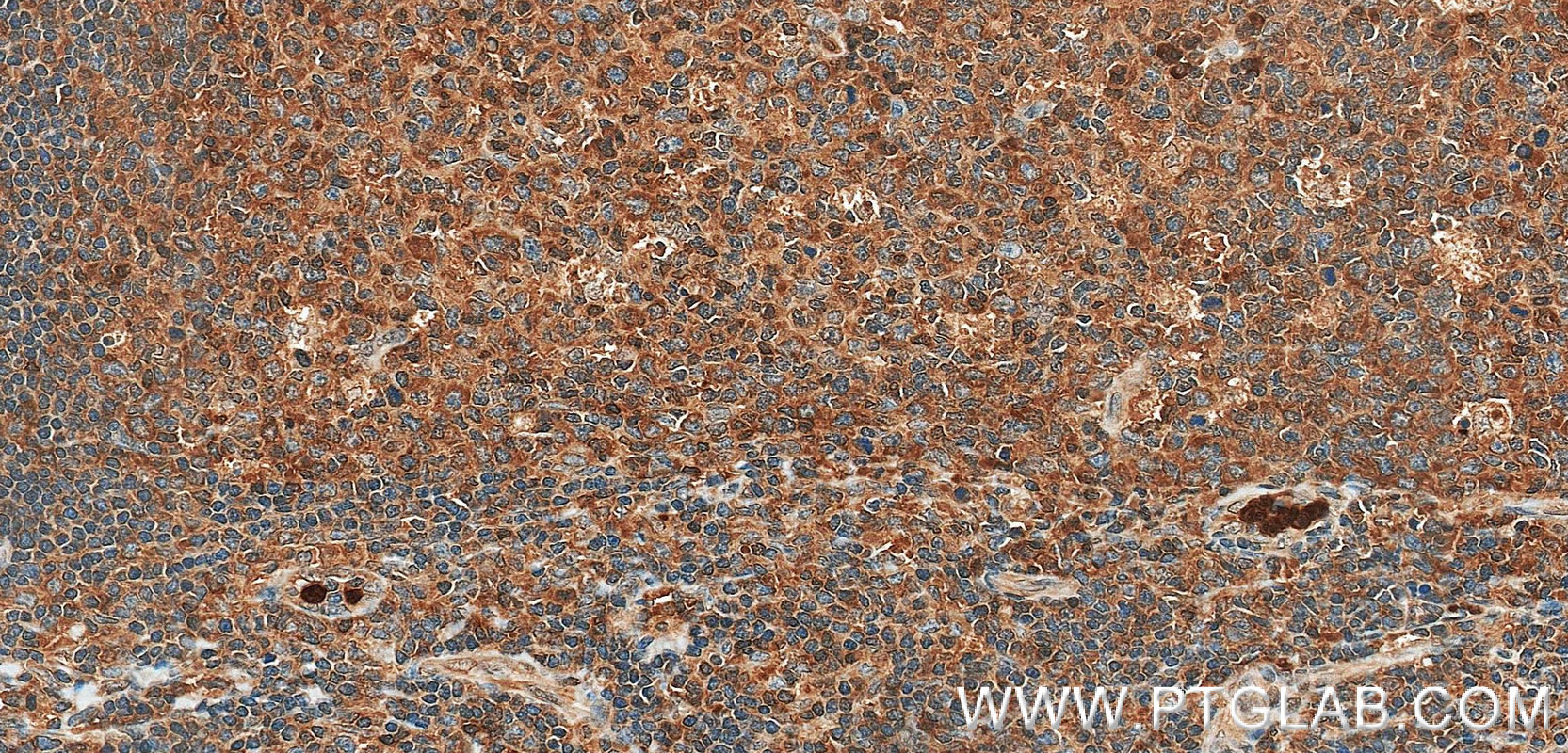 IHC staining of human tonsil using 98942-1-RR IHC staining of human tonsil using 98942-1-RR
