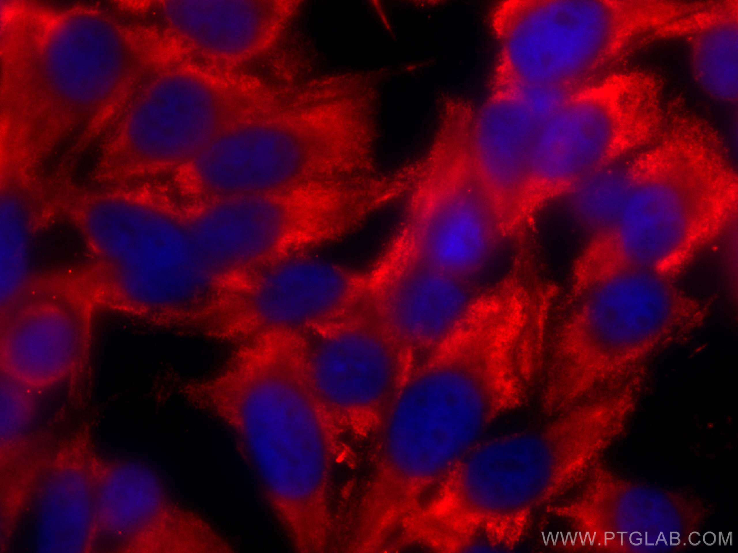 IF Staining of PC-3 using CL594-67178