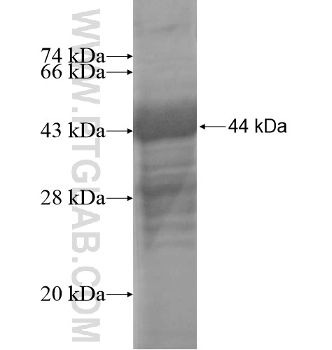GPIHBP1 fusion protein Ag15565 SDS-PAGE GPIHBP1 fusion protein Ag15565 SDS-PAGE