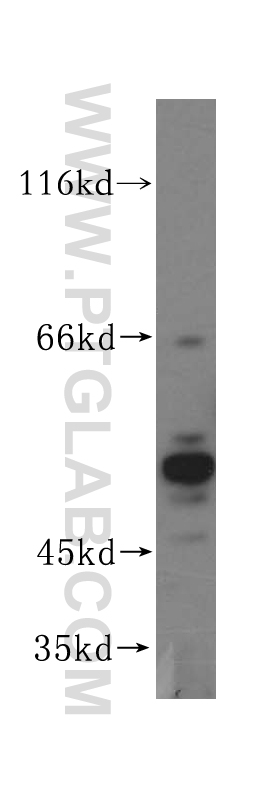 WB analysis of HeLa using 14728-1-AP