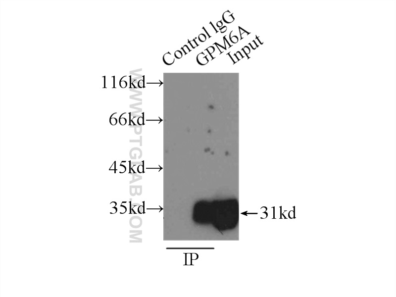 IP experiment of mouse brain using 15044-1-AP