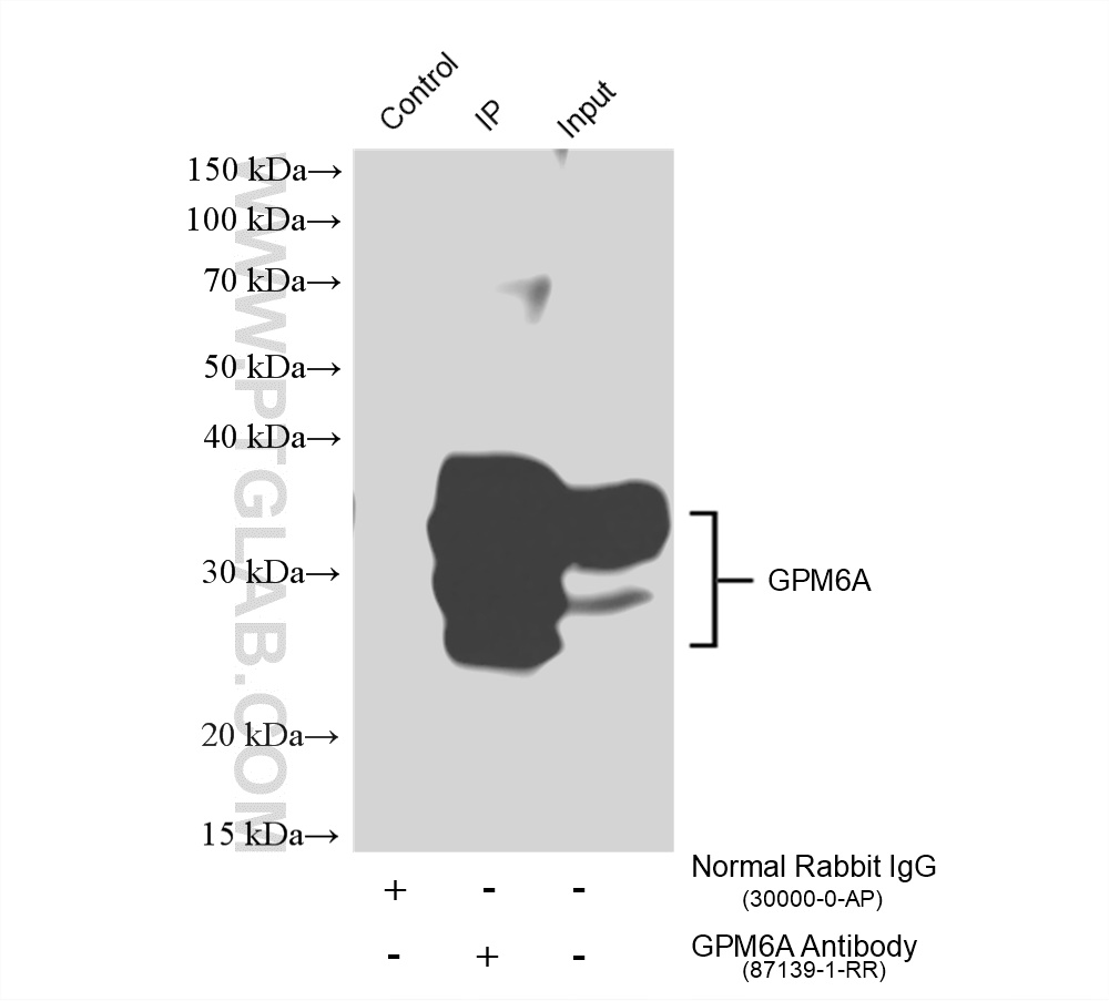 IP experiment of mouse brain using 87139-1-RR (same clone as 87139-1-PBS)