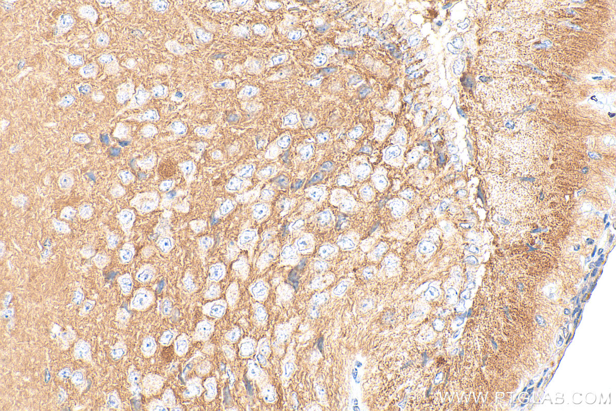 IHC staining of mouse brain using Biotin-15044