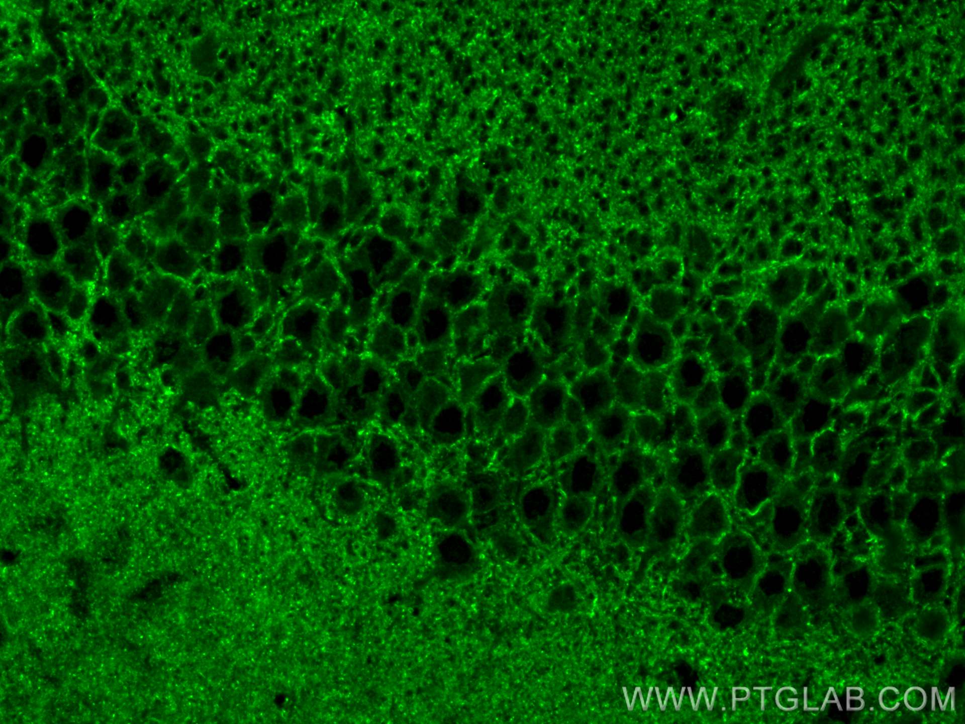 IF Staining of mouse brain using 26122-1-AP (same clone as 26122-1-PBS)
