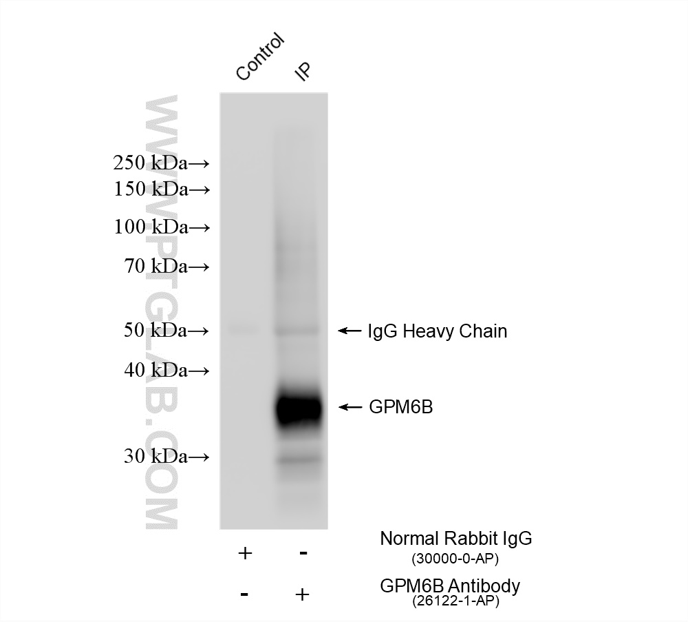 IP experiment of rat brain using 26122-1-AP (same clone as 26122-1-PBS)