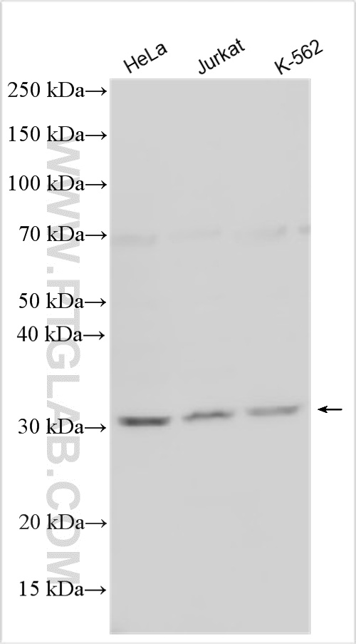 Various lysates were subjected to SDS PAGE followed by western blot with 33504-1-AP (GPN2 antibody) at dilution of 1:1500 incubated at room temperature for 1.5 hours. WB analysis using 33504-1-AP