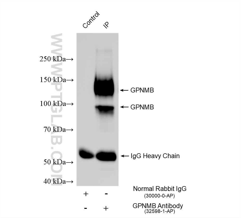 IP experiment of rat spleen using 32598-1-AP IP experiment of rat spleen using 32598-1-AP