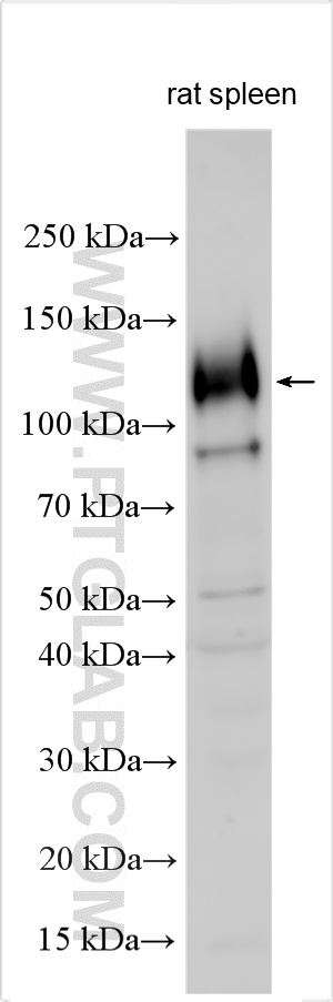 Rat spleen tissue were subjected to SDS PAGE followed by western blot with 32598-1-AP (GPNMB antibody) at dilution of 1:400 incubated at room temperature for 1.5 hours. WB analysis using 32598-1-AP
