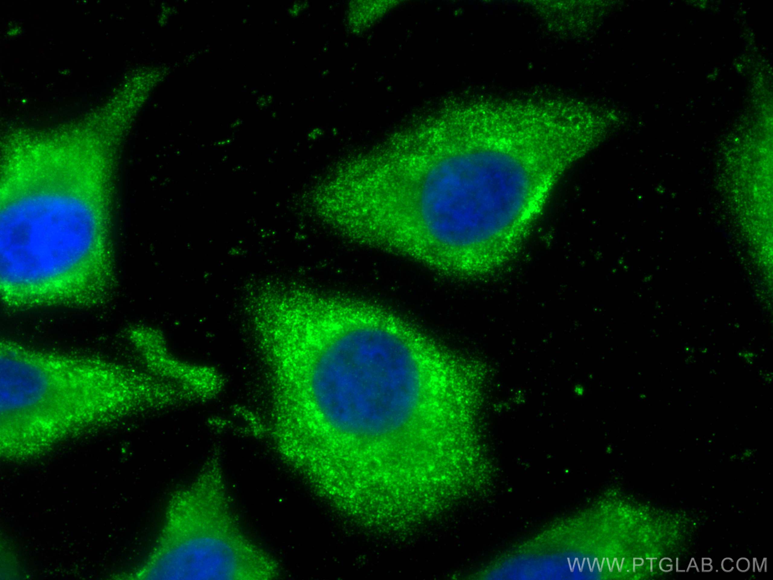 IF Staining of HeLa using 66926-1-Ig