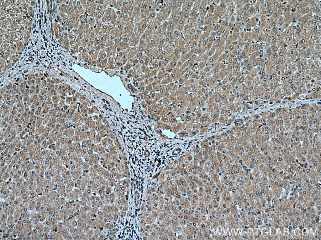 IHC staining of human liver using 66926-1-Ig