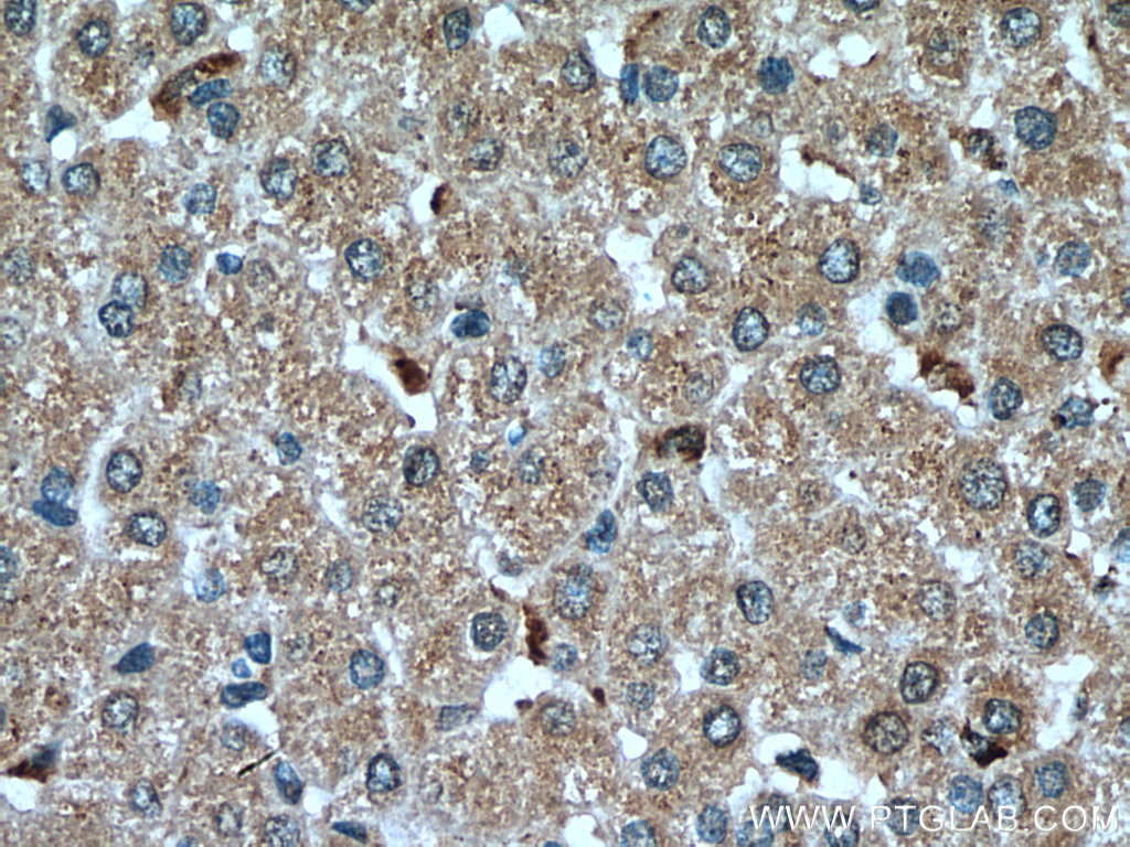 IHC staining of human liver using 66926-1-Ig