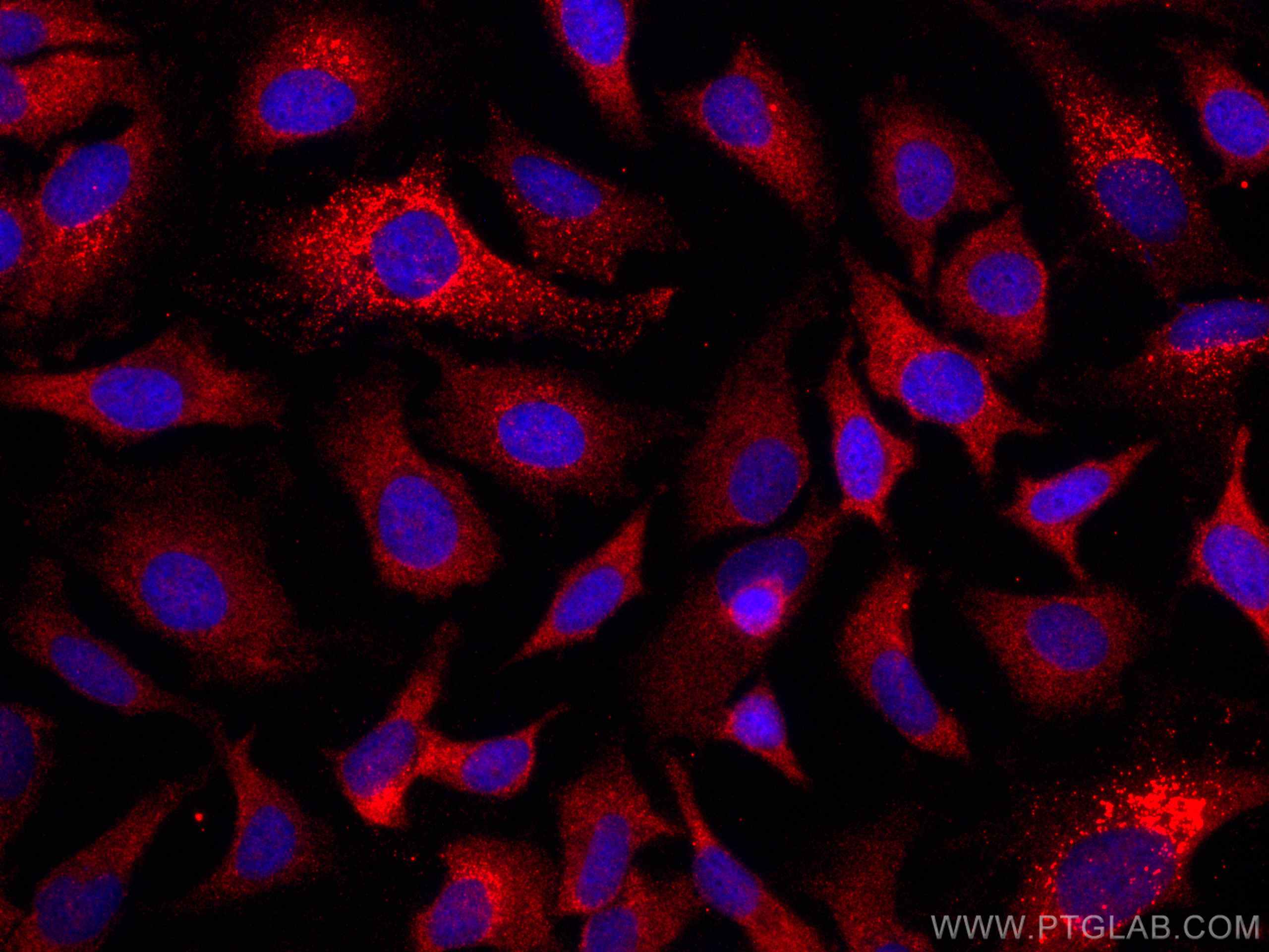 IF Staining of HeLa using CL594-66926