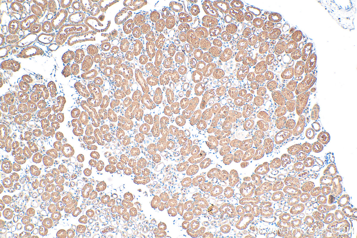 IHC staining of mouse kidney using 20074-1-AP