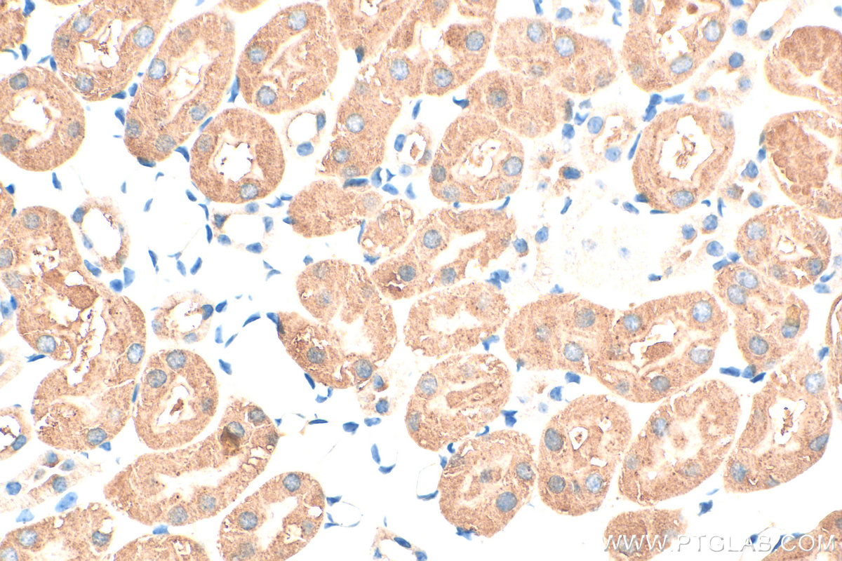 IHC staining of mouse kidney using 20074-1-AP