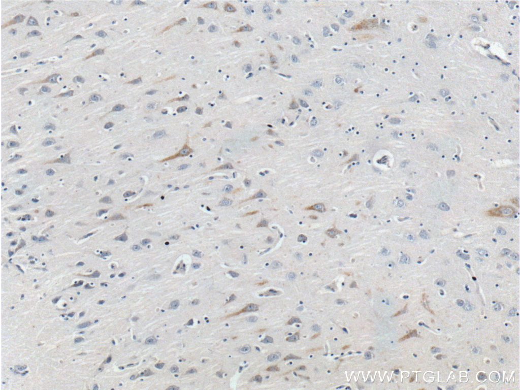 IHC staining of human brain using 25247-1-AP