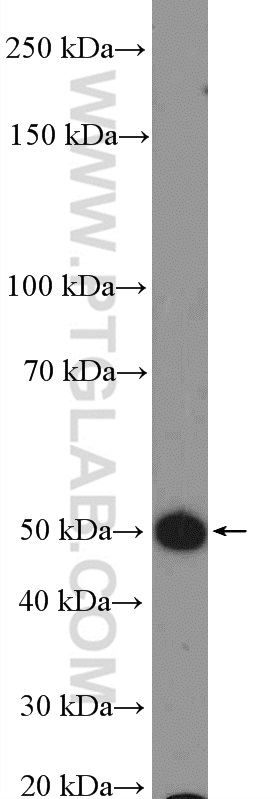 WB analysis of mouse brain using 25247-1-AP