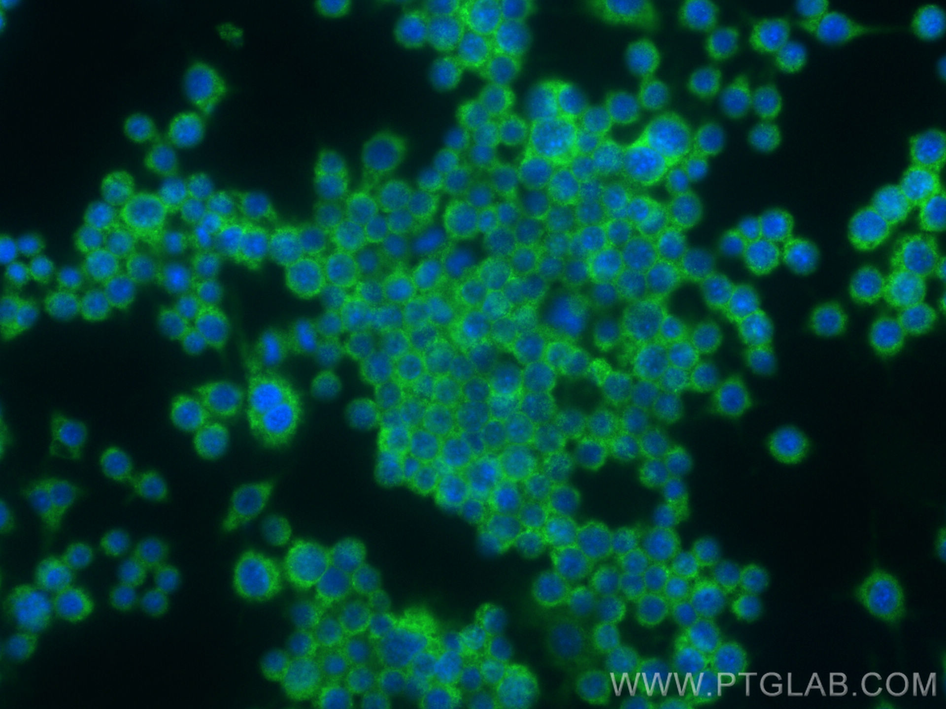 IF Staining of RAW 264.7 using 31781-1-AP
