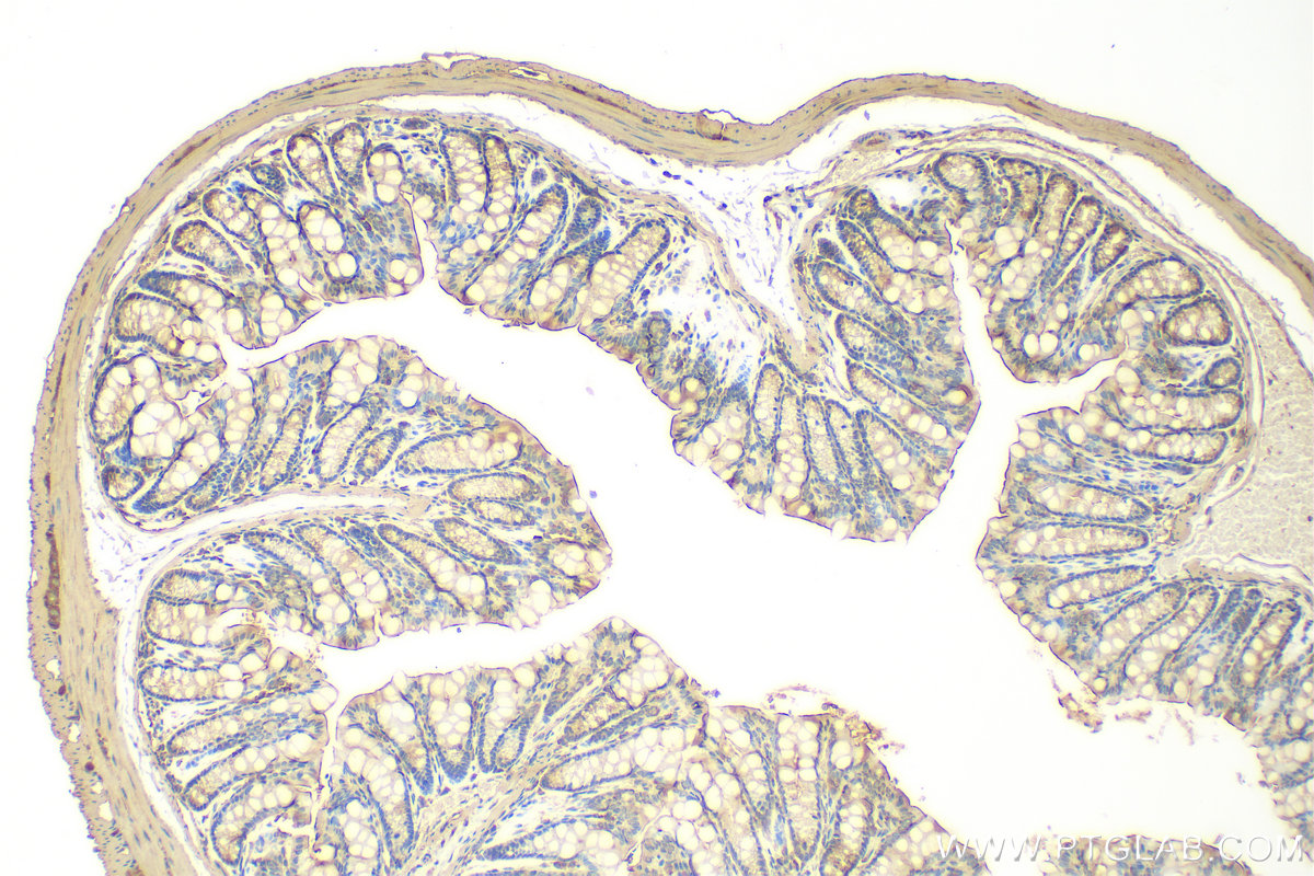 IHC staining of mouse colon using 31781-1-AP