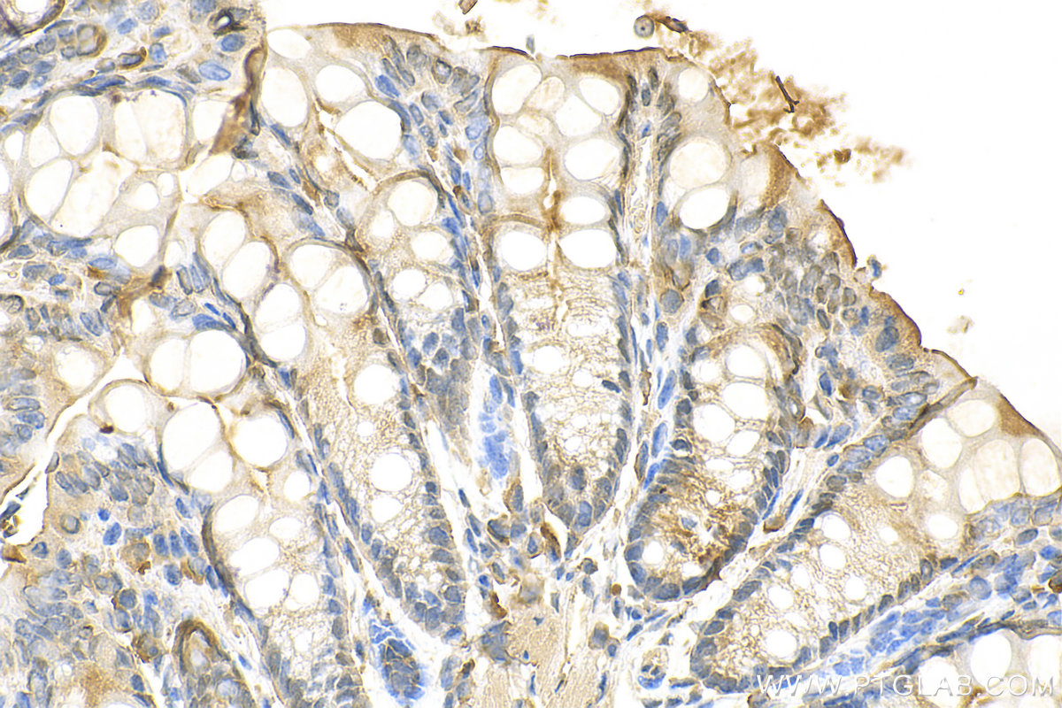 IHC staining of mouse colon using 31781-1-AP