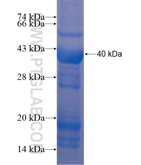 GPR113 fusion protein Ag19438 SDS-PAGE GPR113 fusion protein Ag19438 SDS-PAGE