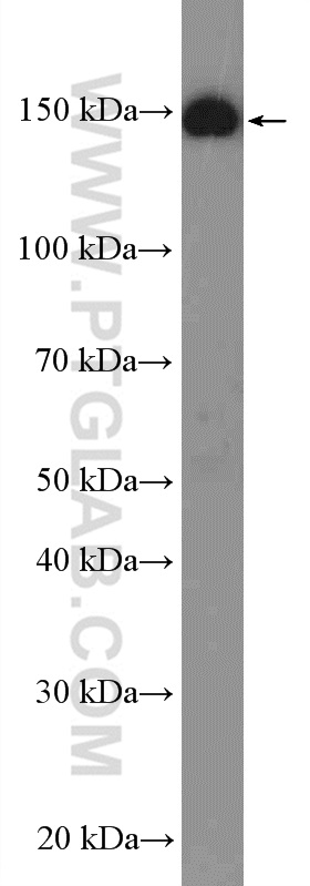 WB analysis of HEK-293 using 14047-1-AP