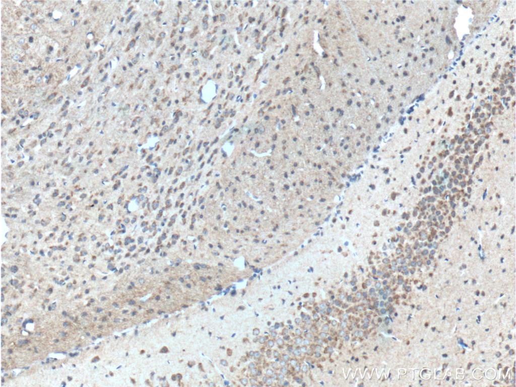 IHC staining of mouse brain using 11912-1-AP