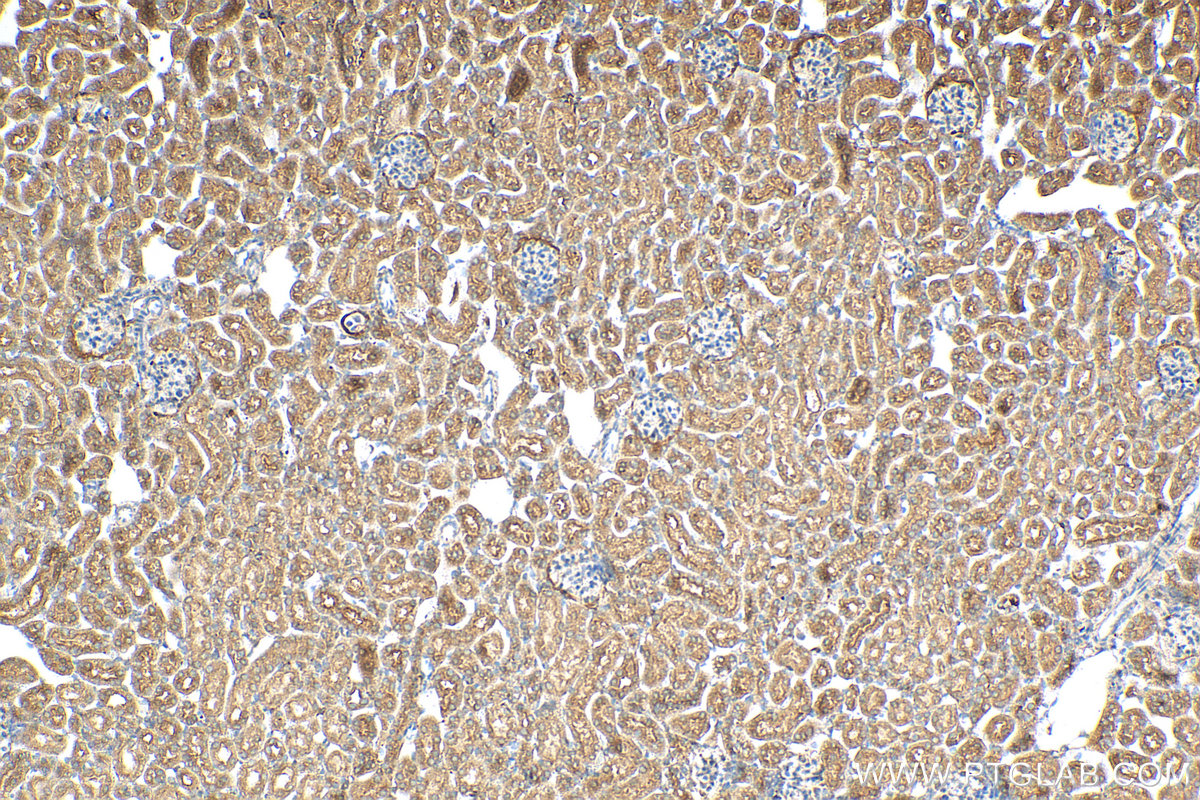 IHC staining of mouse kidney using 17774-1-AP