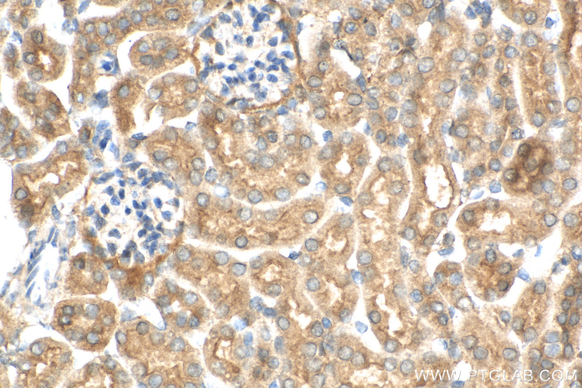 IHC staining of mouse kidney using 17774-1-AP