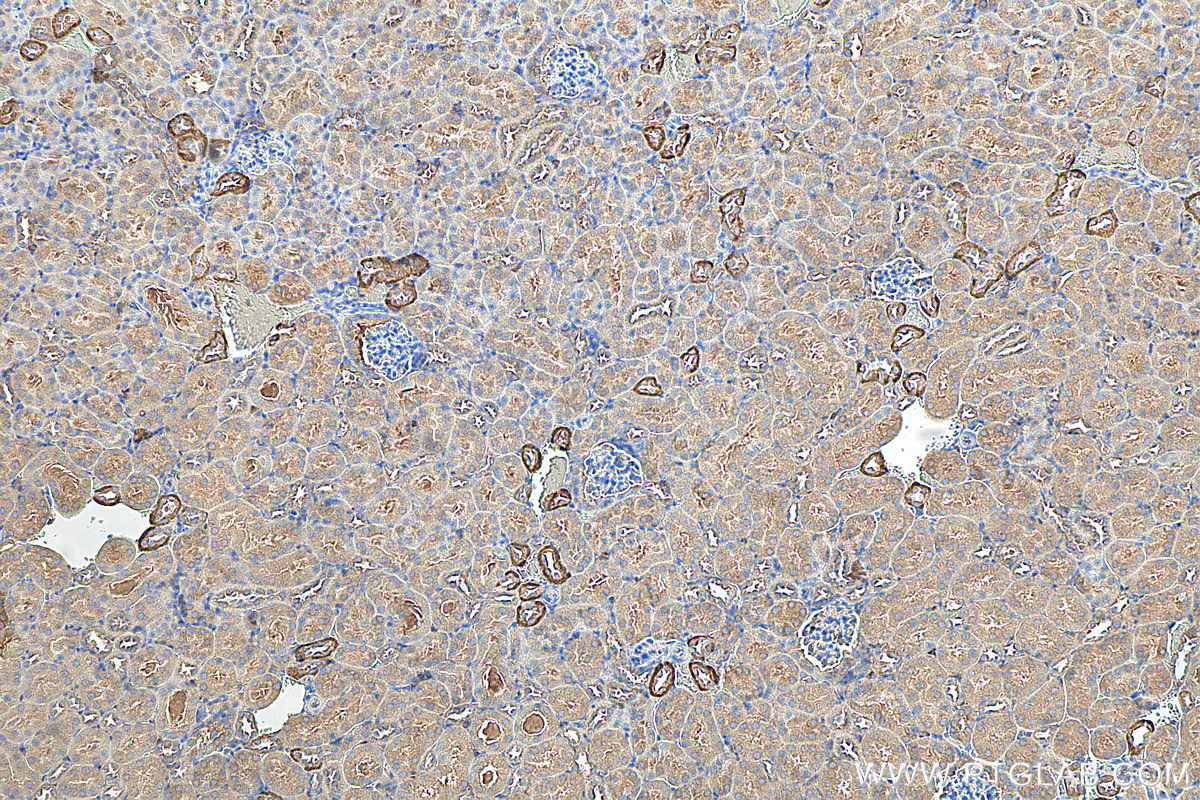 IHC staining of mouse kidney using 81632-1-RR