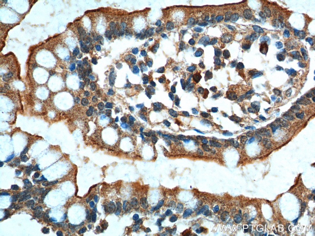 IHC staining of human small intestine using 24784-1-AP