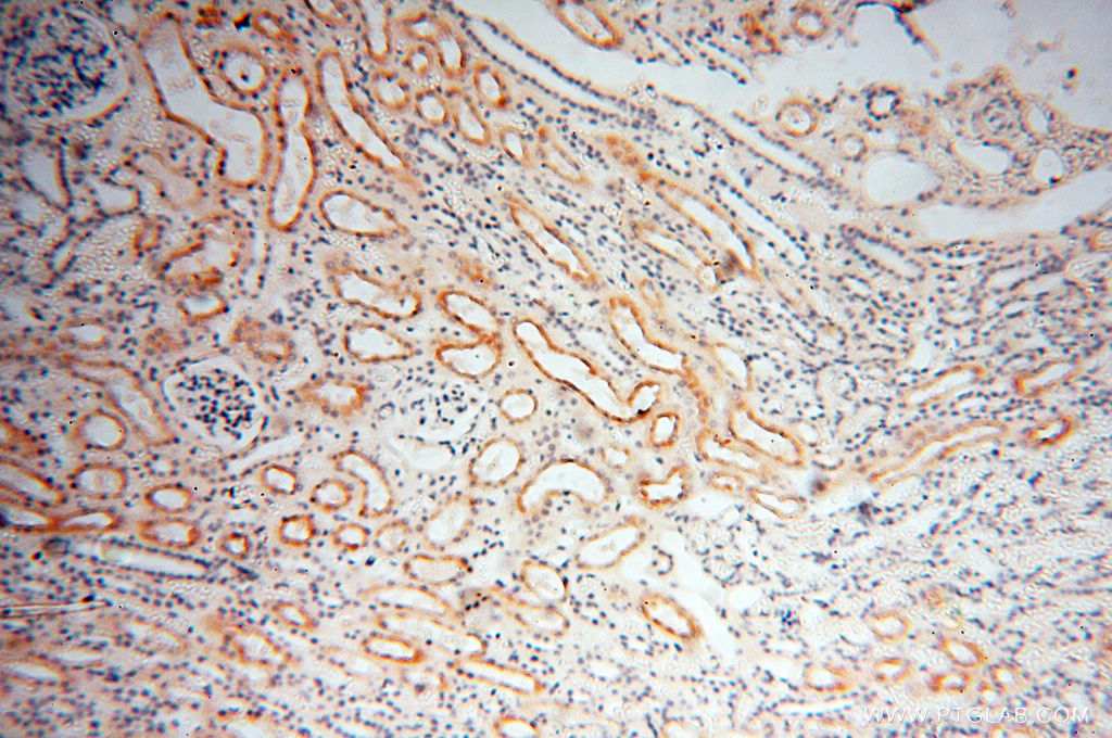 IHC staining of human kidney using 17026-1-AP