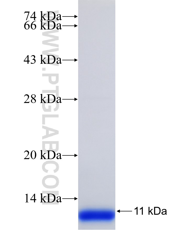 GPR132 fusion protein Ag31359 SDS-PAGE GPR132 fusion protein Ag31359 SDS-PAGE