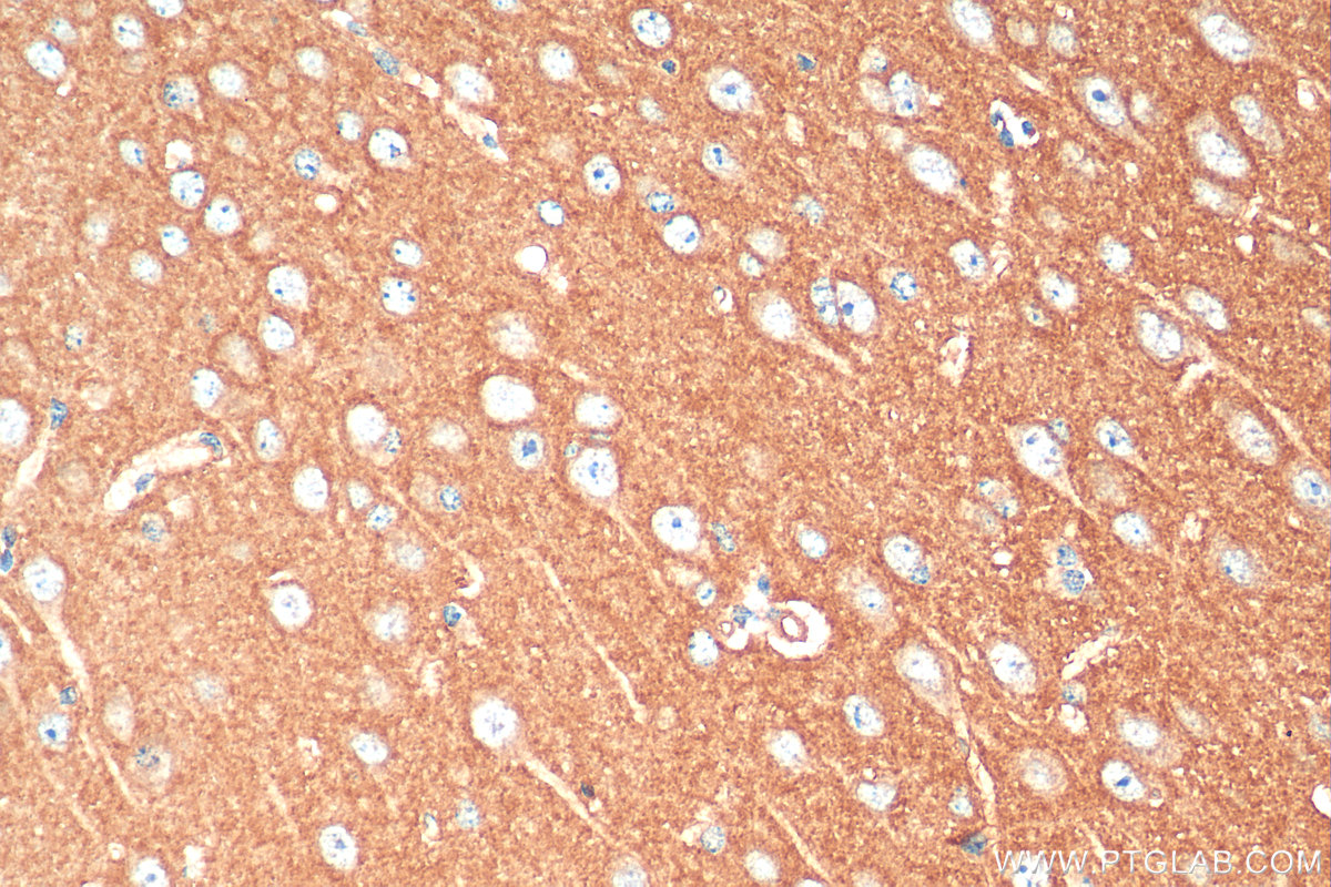 IHC staining of mouse brain using 11929-1-AP