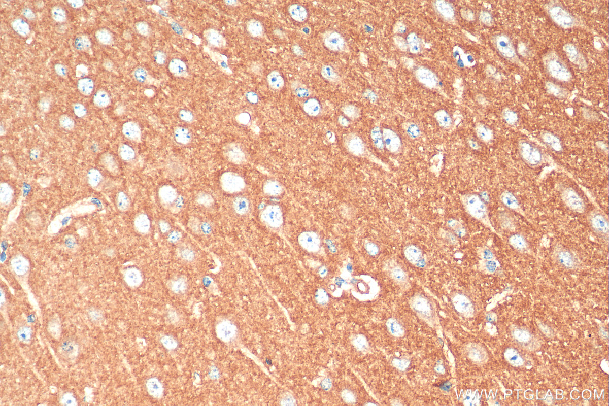 IHC staining of mouse brain using 11929-1-AP (same clone as 11929-1-PBS)