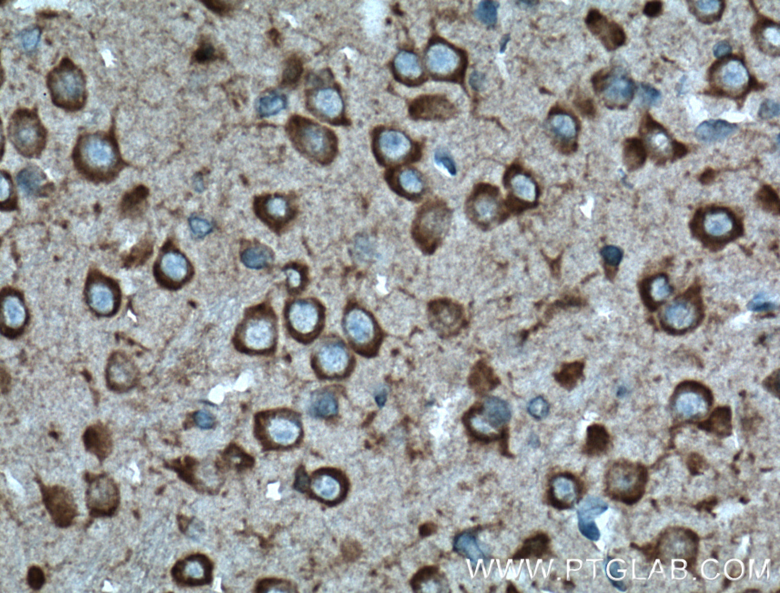 IHC staining of mouse brain using 11929-1-AP (same clone as 11929-1-PBS)