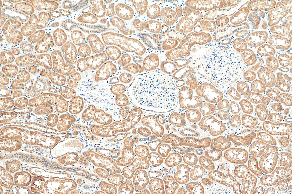 IHC staining of human kidney using 16496-1-AP