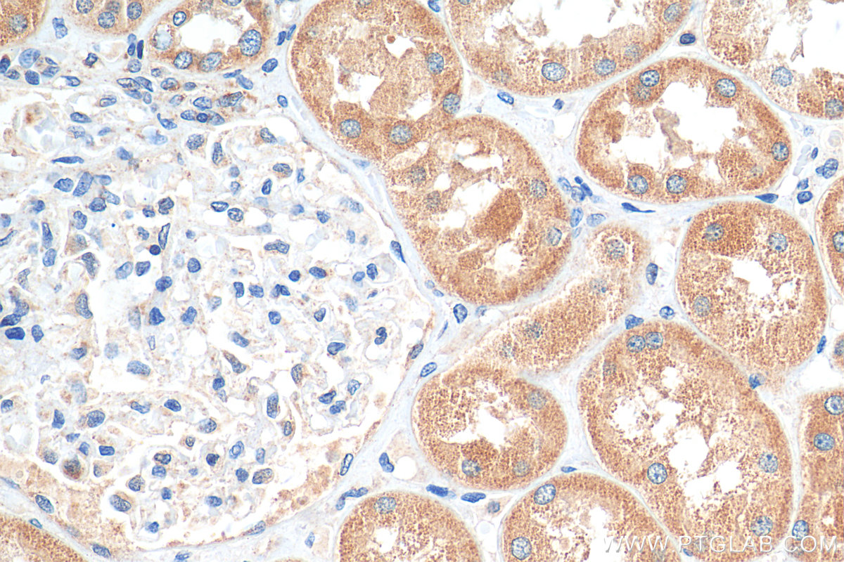 IHC staining of human kidney using 16496-1-AP