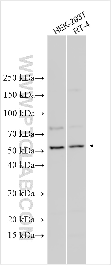 WB analysis using 16496-1-AP