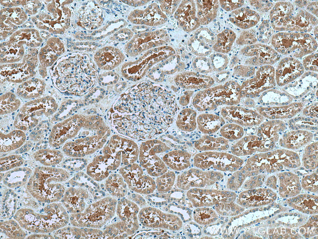 IHC staining of human kidney using 28096-1-AP