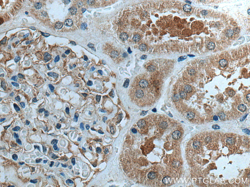 IHC staining of human kidney using 28096-1-AP