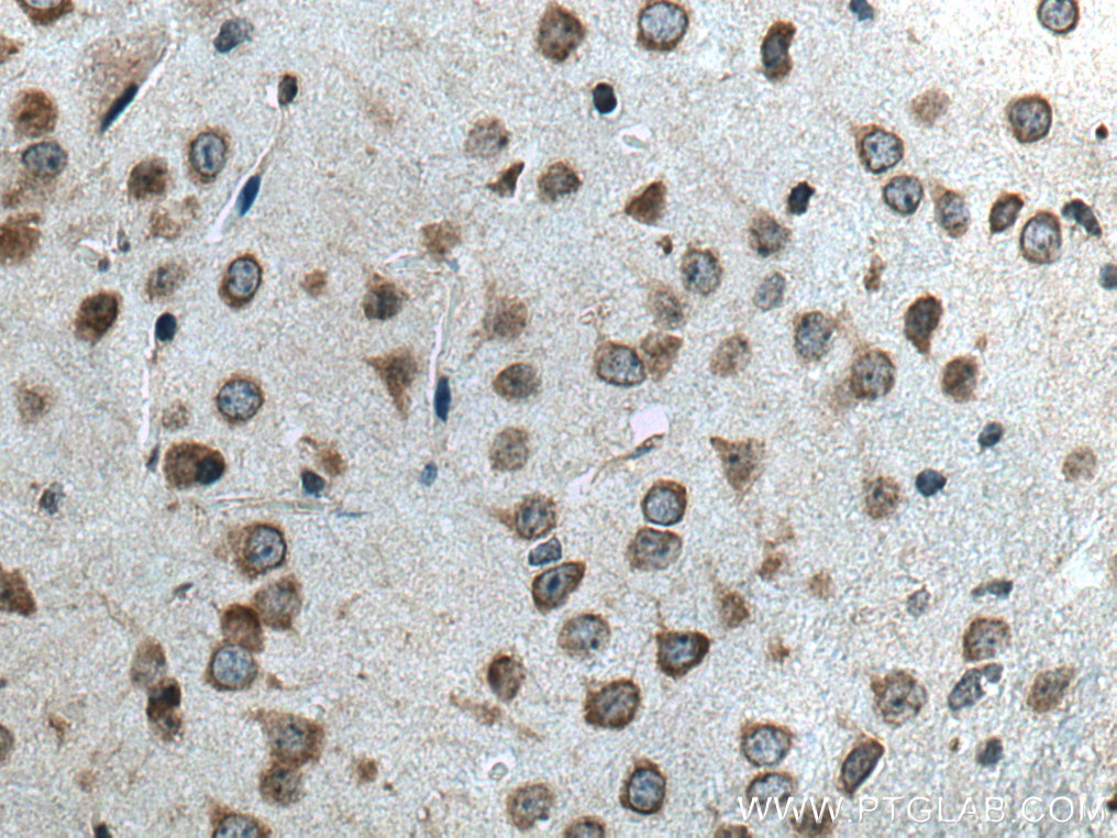 IHC staining of mouse brain using 28096-1-AP