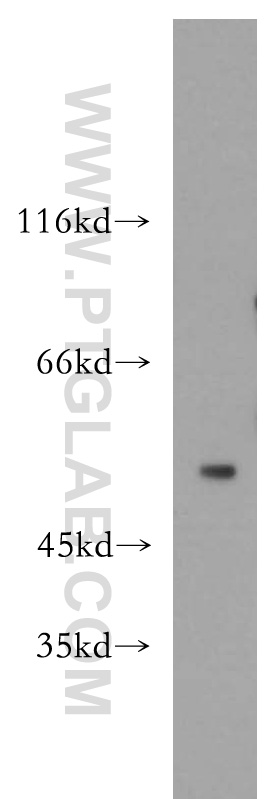 WB analysis of SH-SY5Y using 18820-1-AP