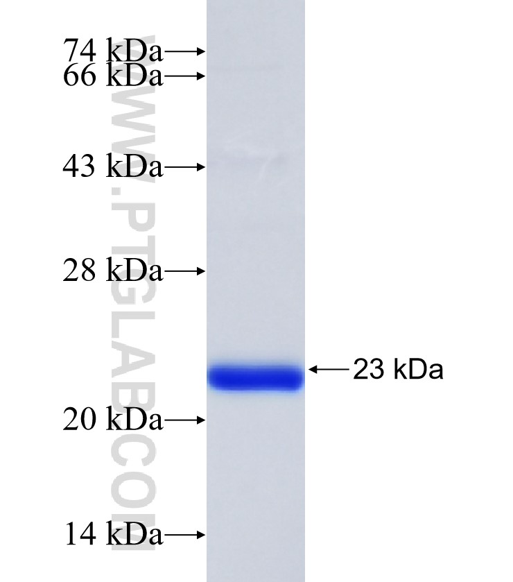 GPR142 fusion protein Ag35358 SDS-PAGE GPR142 fusion protein Ag35358 SDS-PAGE