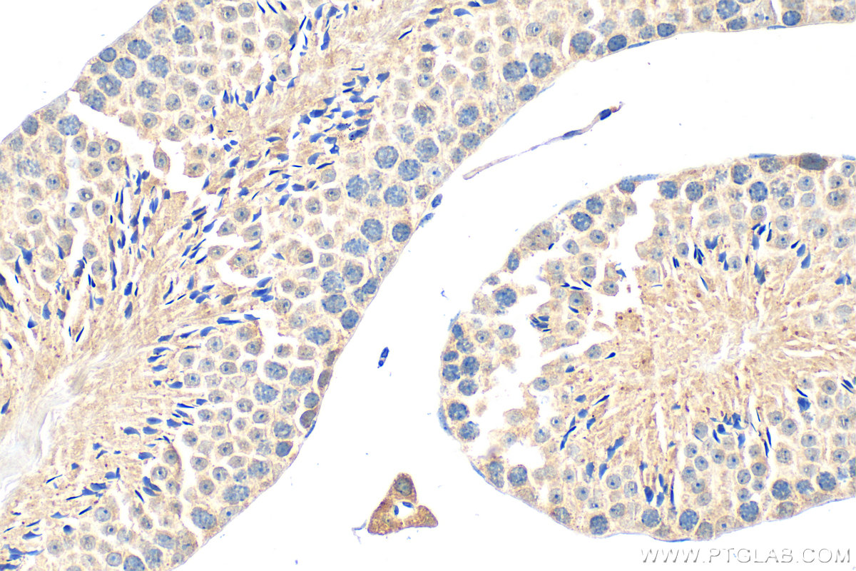 IHC staining of mouse testis using 25996-1-AP