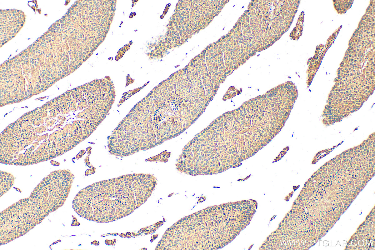 IHC staining of mouse testis using 25996-1-AP