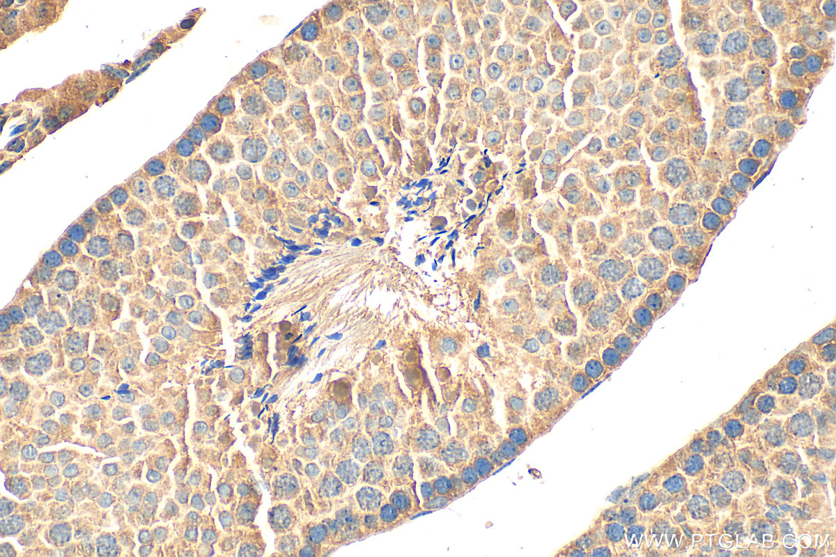 IHC staining of mouse testis using 25996-1-AP