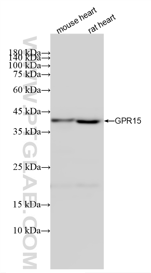 WB analysis using 87491-1-RR (same clone as 87491-1-PBS)