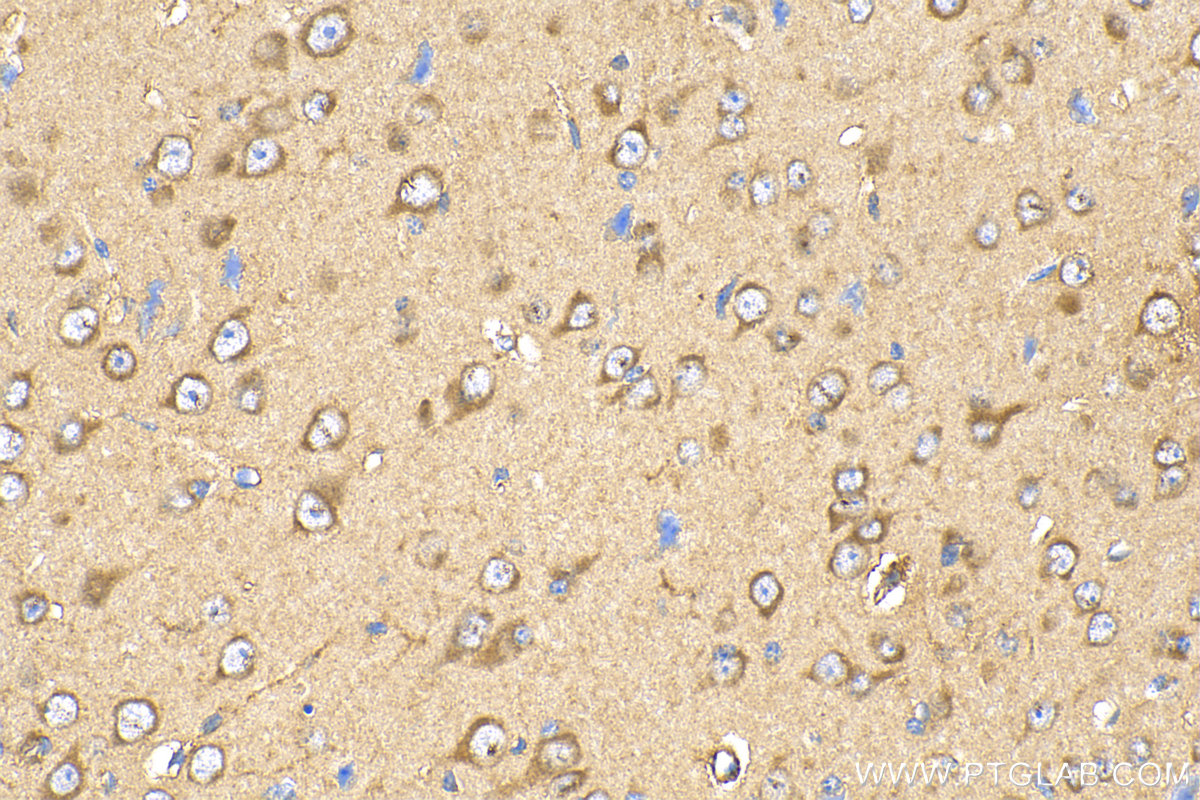IHC staining of mouse brain using 20213-1-AP