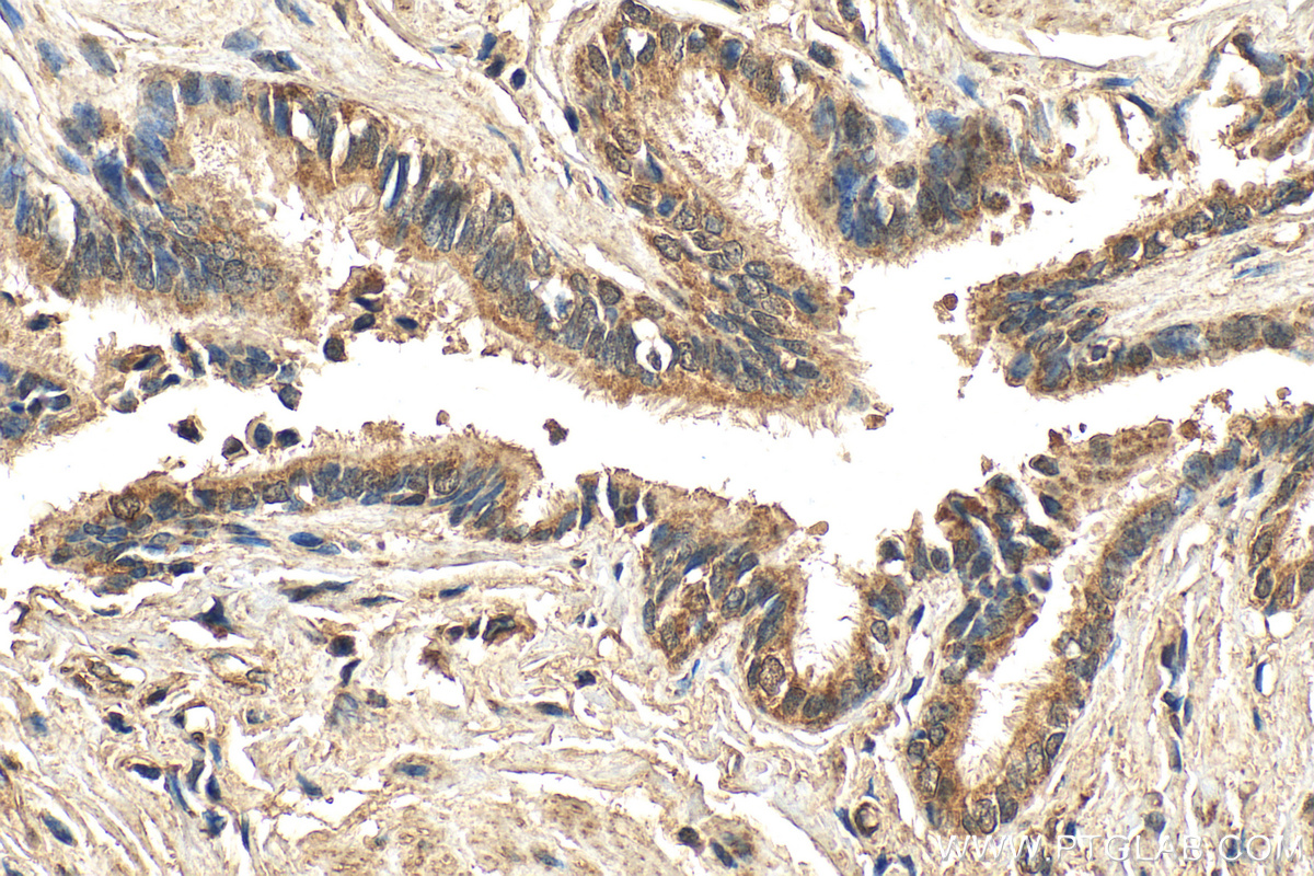 IHC staining of human lung using 30104-1-AP
